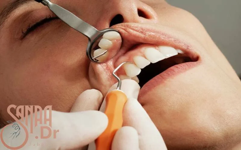 آیا عصب کشی دندان عوارض دارد؟