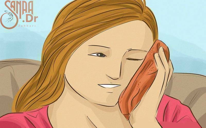 ورم صورت بعد از عصب کشی