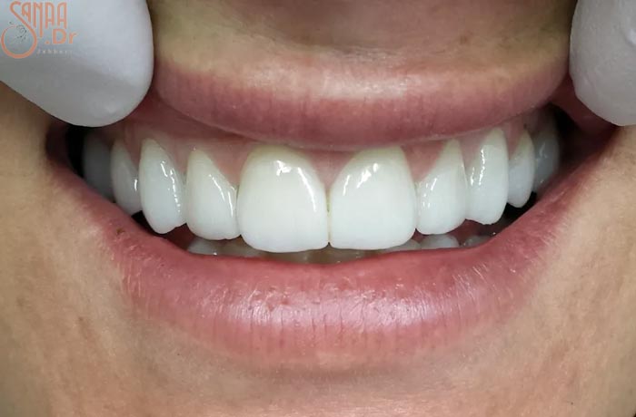 دندان های سفید فرد