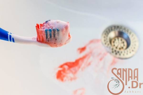علت خونریزی لثه هنگام مسواک زدن