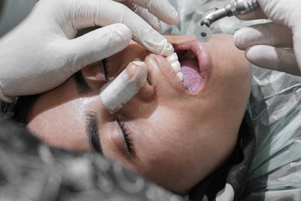 دندانپزشکی بعد از عمل بینی
