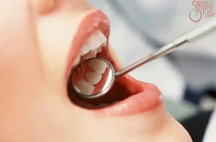 دهان باز یک فرد و یک آیینه دندان پزشکی