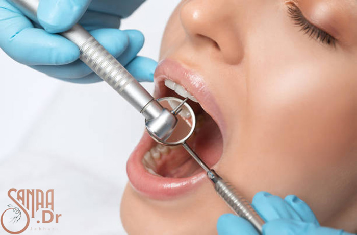 معاینه دندان یک خانم به همراه آیینه دندان پزشکی