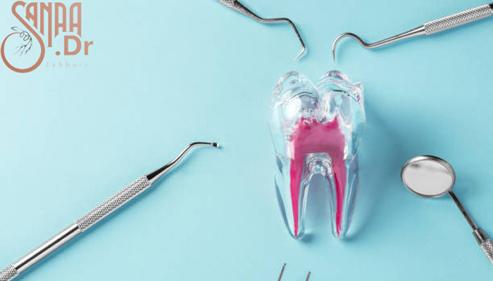 هزینه عصب کشی دندان به همراه ابزار عصب کشی
